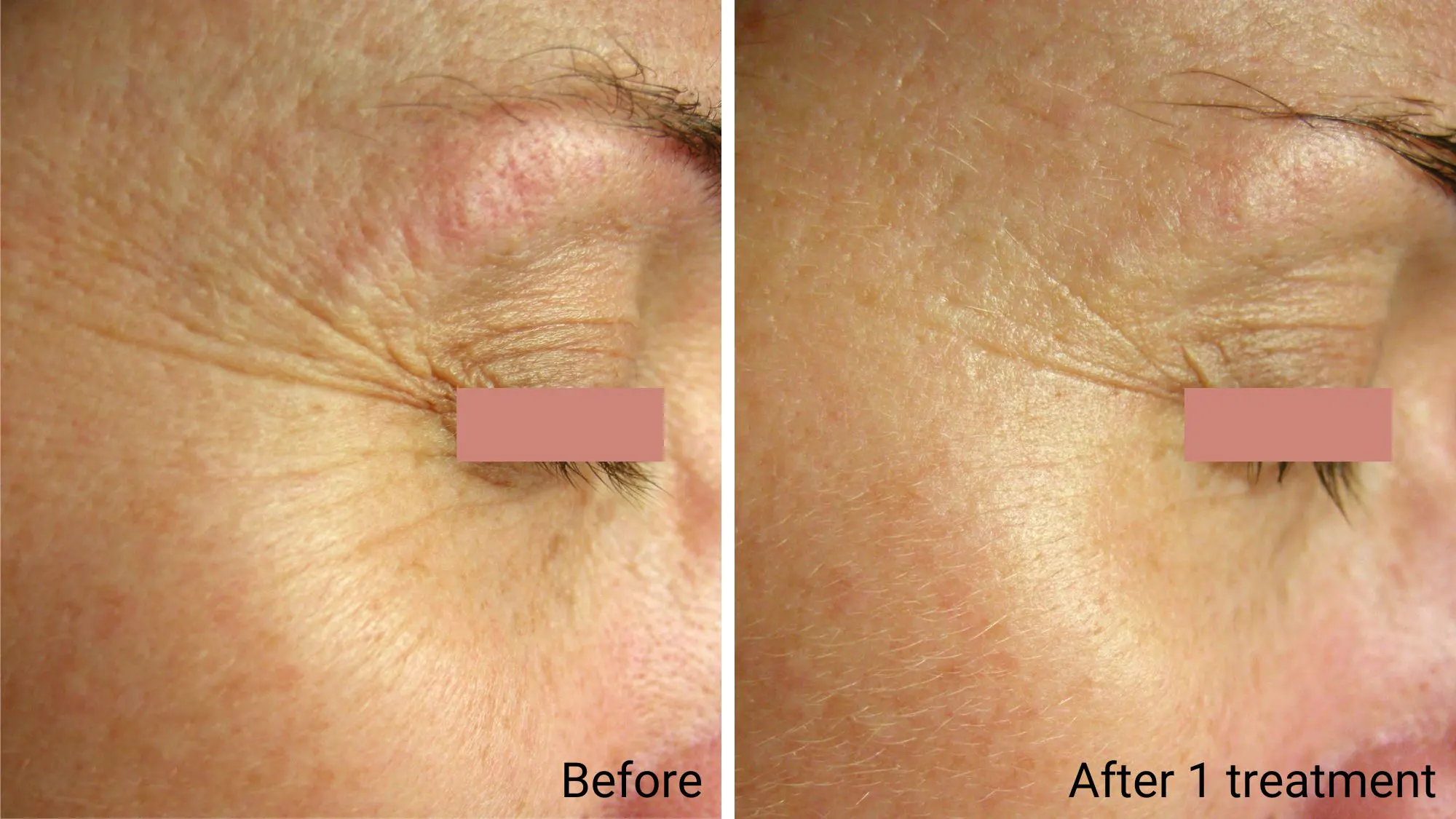 Collagen lift and firming facial / Soin du visage lift au collagène